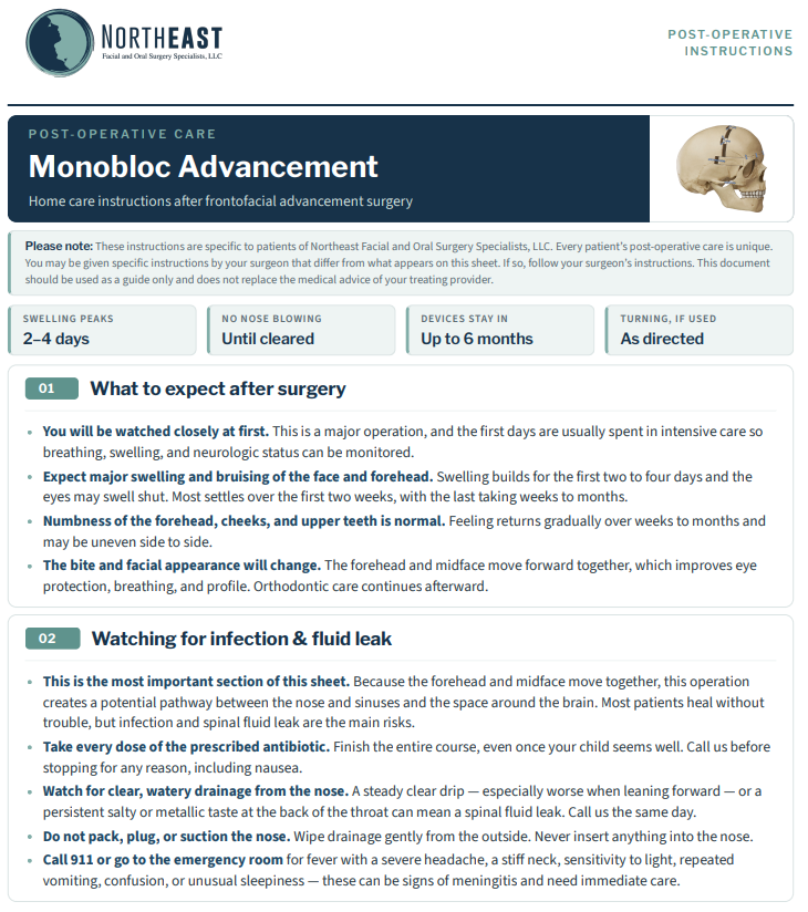 Monobloc Advancement Post-Op Preview Monobloc advancement post-operative instructions preview