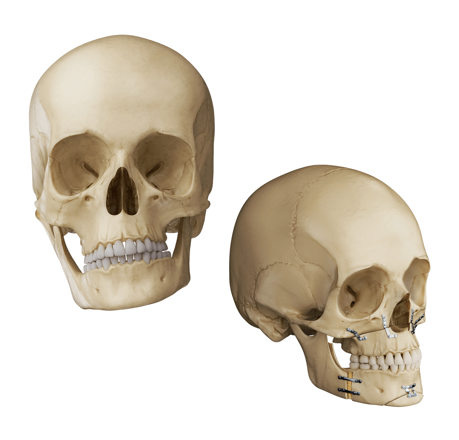 facial-asymmetry-correction-illustration.png