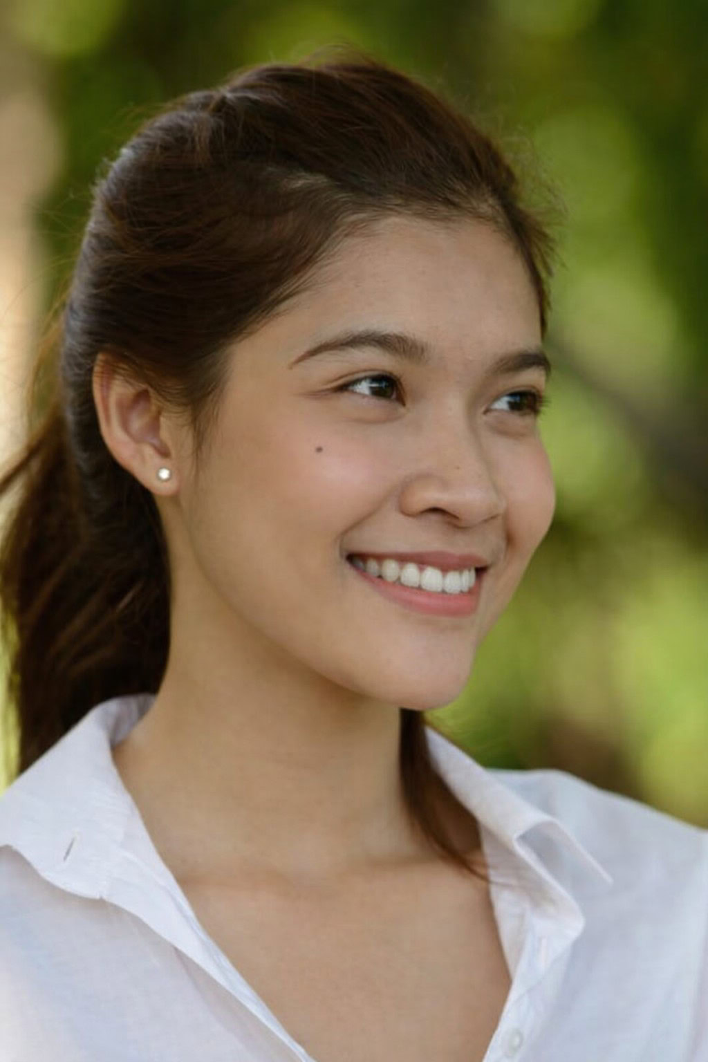 young-teenage-brunette-smile-park-scaled-1 Young woman smiling outdoors after facial asymmetry correction.