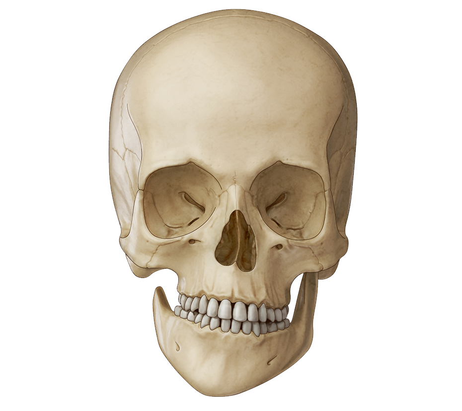 Illustration of hemifacial microsomia showing underdevelopment of one side of the face.