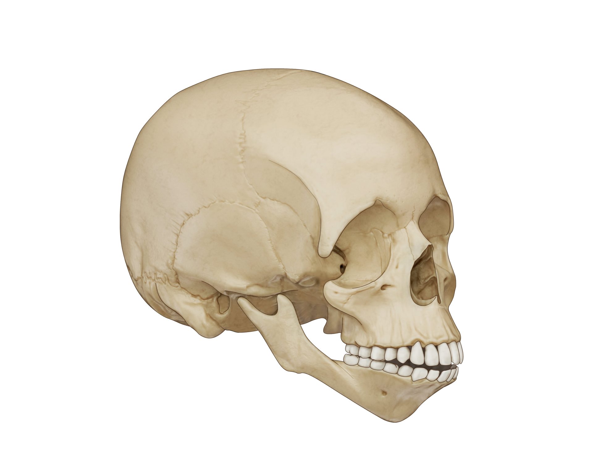Illustration of Treacher Collins skull