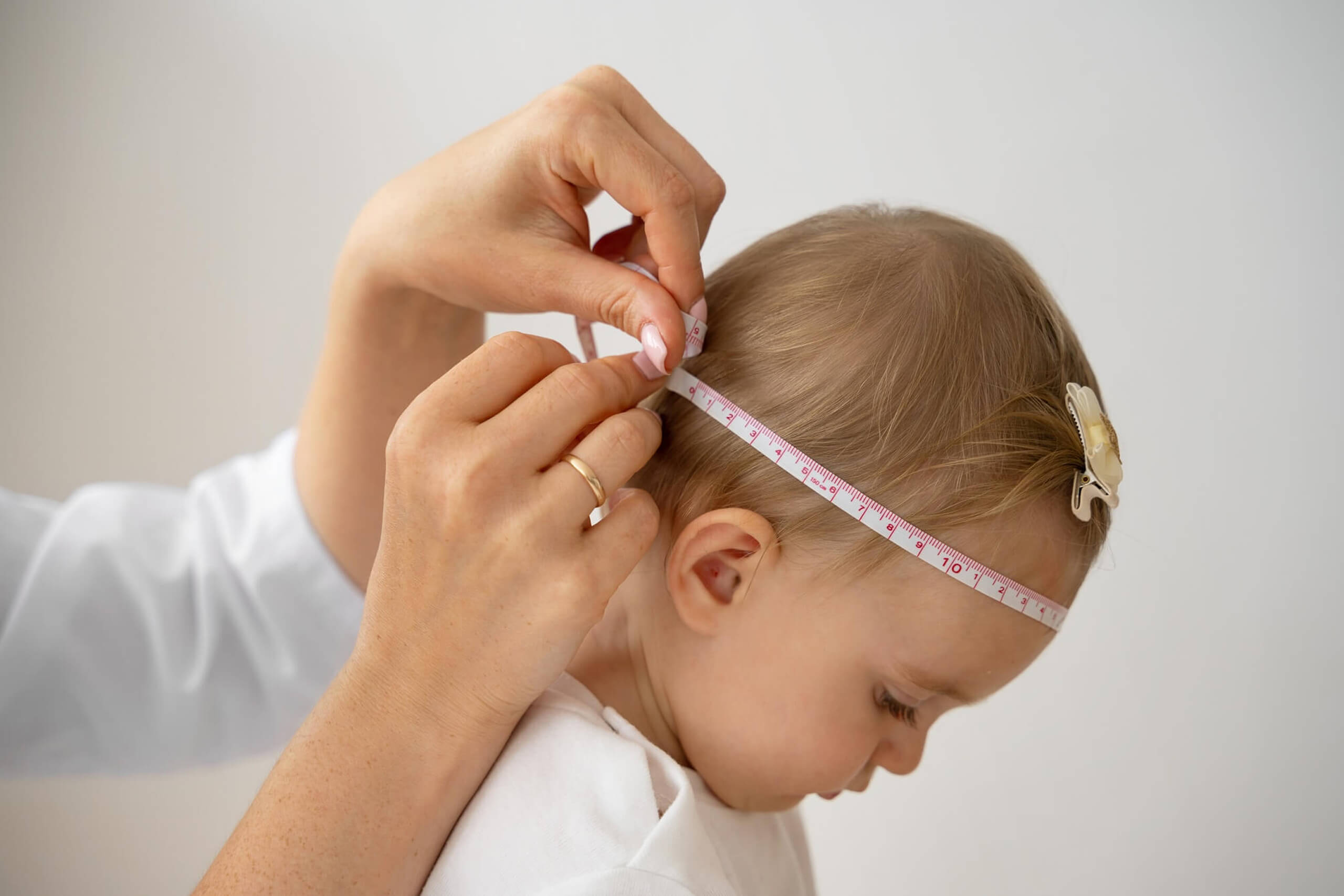 Infant representing cranial growth monitoring.