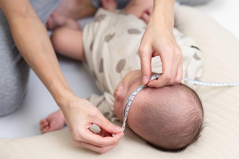 Infant head being measured during a craniofacial evaluation.