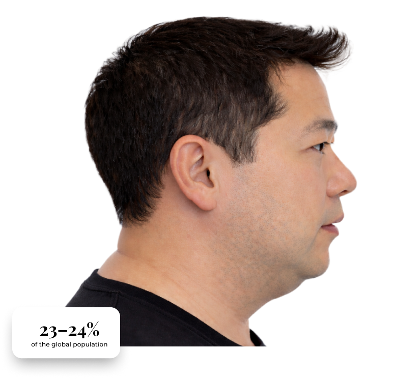 jaw-related-sleep-apnea-clinical-presentation-6.png