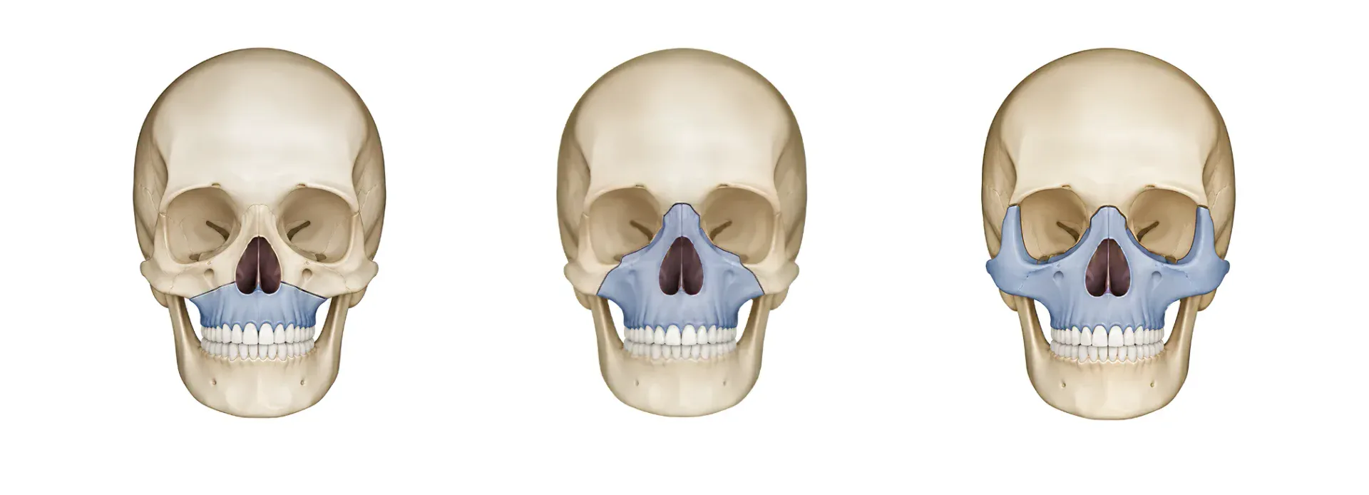 Detailed view of skull showing dental and maxillofacial structures.