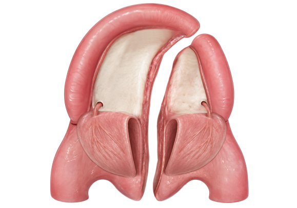 bardach 3 - reframed - wide Illustration of the two mucoperiosteal flaps raised from the palate in Bardach palatoplasty.
