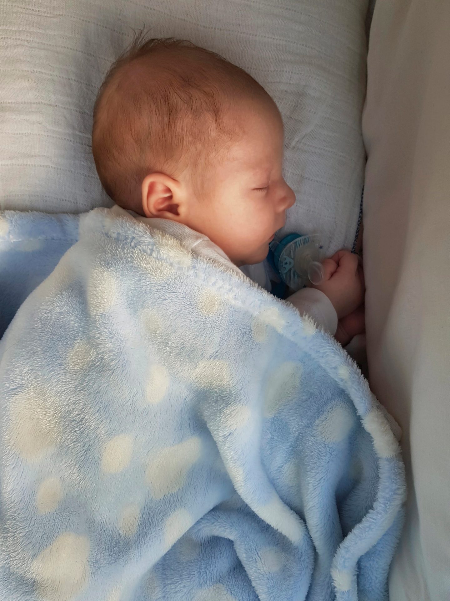 Depositphotos_526347010_XL-min Newborn with a bilateral cleft lip