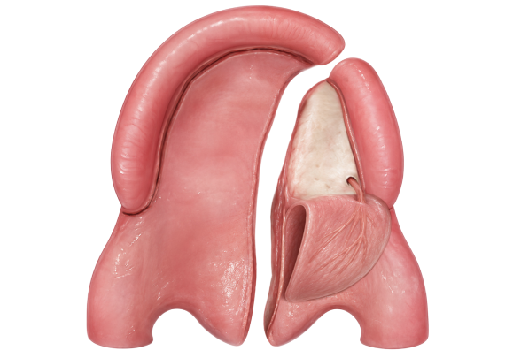 bardach 2 - reframed - wide Illustration of one mucoperiosteal flap raised in Bardach two flap palatoplasty.