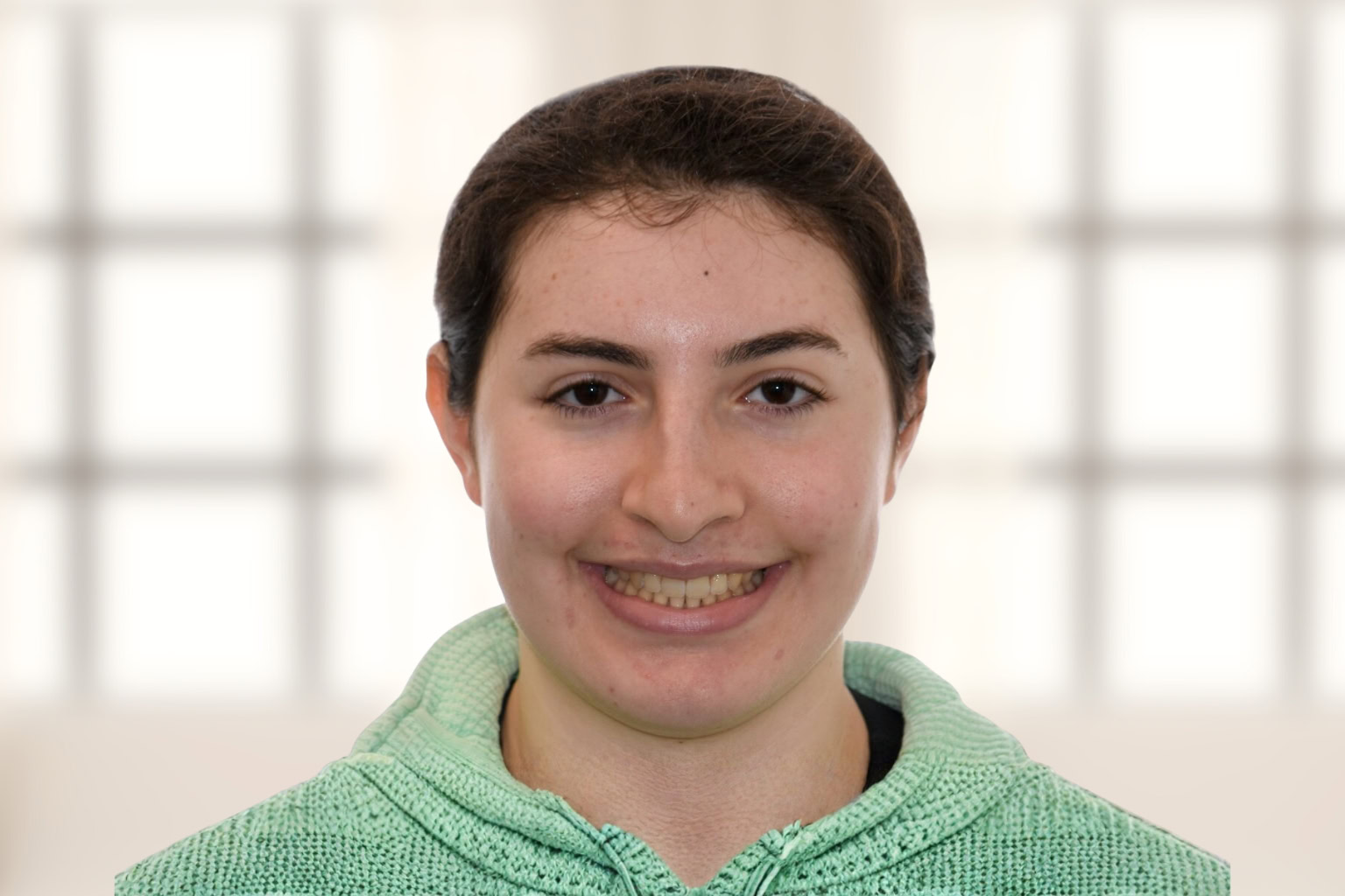 Post-Operative Photo of a patient treated with orthognathic for anterior open bite at the Jaw Surgery Center of New Jersey.