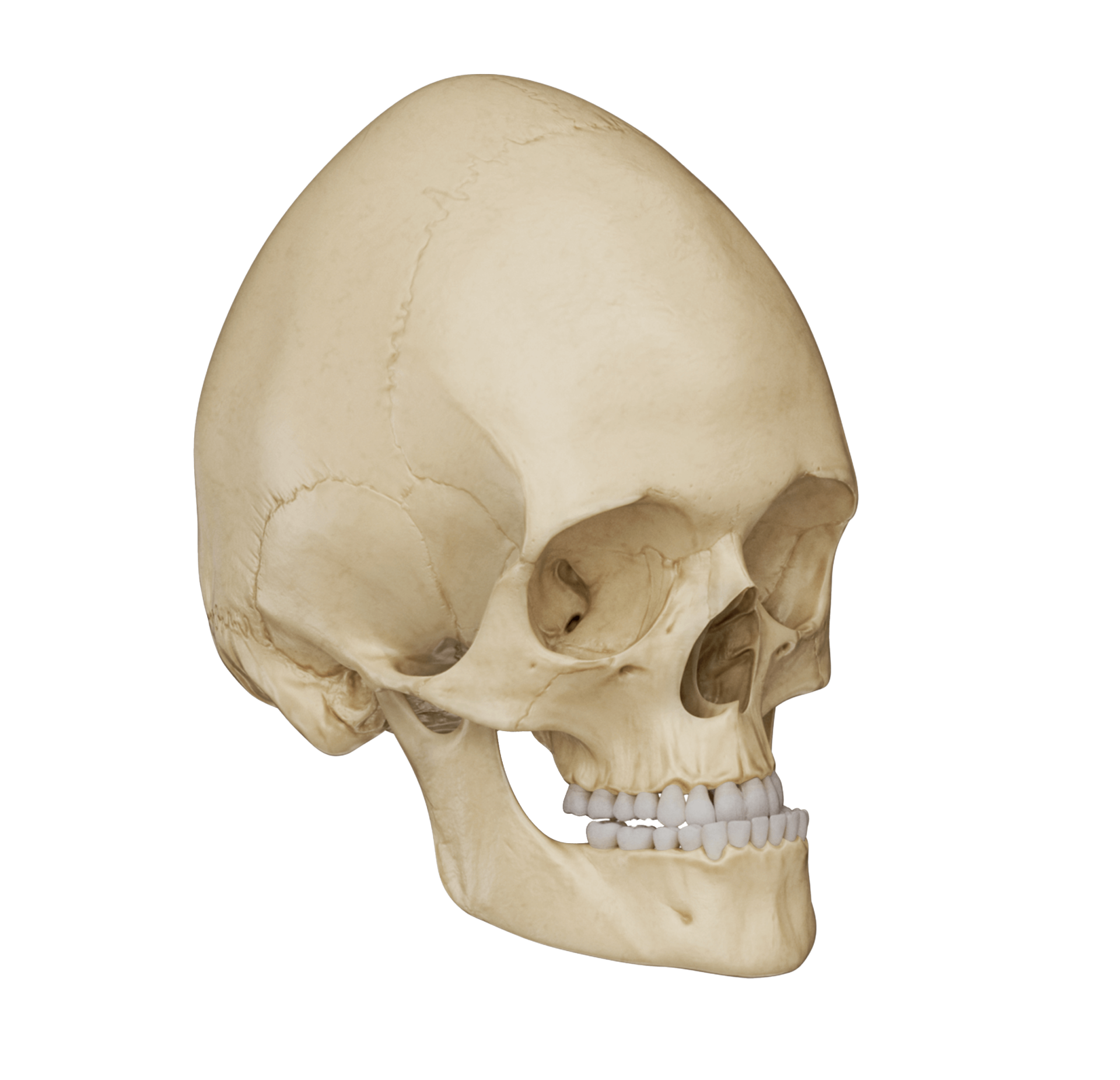 Illustration of craniofacial features of Pfeiffer syndrome.