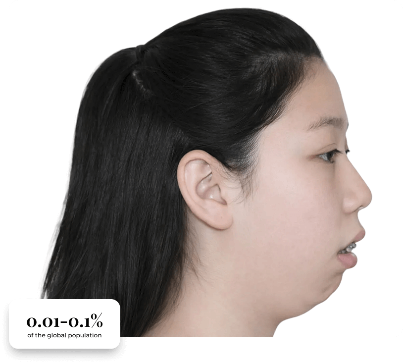 Young woman with facial profile showing jaw and chin structure.